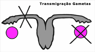 HC - LABREPTransmigração de gametas. Estudo da salpingectomia